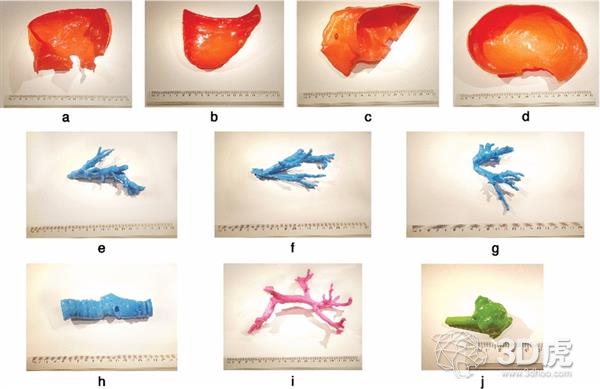 波蘭研究人員借FDM 3D打印機造低成本術前肝臟模型