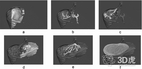 波蘭研究人員借FDM 3D打印機造低成本術前肝臟模型